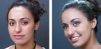 Cover Acne with Makeup