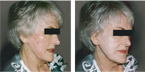 Cover After Care with Makeup