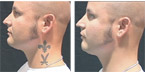 Cover Tattoo with Makeup